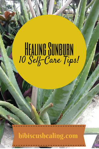 How to heal sunburn