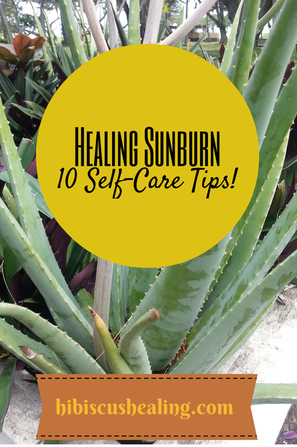 Healing Sunburn